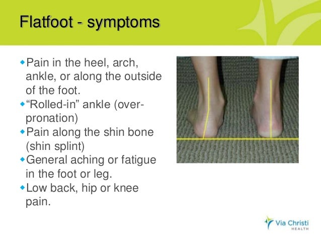 Oh, my aching feet! Presentation by Dr. Miki Matsuda