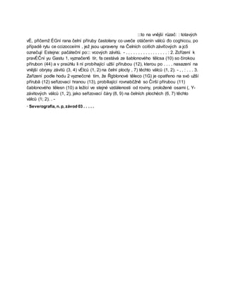 :::to na vnější růzač: : totavých
vÉ, přičemž ÉGní rana čelní příruby častołany co uveče otáčenín válců đo coghiccu, po
případě rytu ce ccizocceírni , jež jsou upraveny na Čelních cci6ch závíťových a jc5
označují Estejna: pačáteční po::: vcových závitů. - . . . . . . . . . . . . . . . . . : 2. Zcřízení k
pravÉČní yu Gastu 1, vyznačen6 tír, fa cestává ze šablonového tělcsa (10) so čirokou
přírubon (44) a v praúhlu li ní probíhající užší přírubou (12), kterou po . . . . nasazení na
vnější obrysy závitů (3, 4) vÉlců (1, 2) na čelní plocty , 7) těchto válců (1, 2). - , , : . . . 3.
Zařízení podle hodu 2 vyznečcné tím, že Řgblonové těleco (1G) je opatřeno na svó užší
přírubă (12) seřizovací hranou (13), probíliající rovnabčžně so Čirší přírubou (11)
čablonového tělesn (10) a ležící ve stejné vzdálenosti od roviny, proložené osami (, Y-
závitových válců (1, 2), jako seřizovací čáry (8, 9) na čelních plochéch (6, 7) těchto
válců (1; 2). . -
· Severografia, n. p, závod 03 . . . . .
 