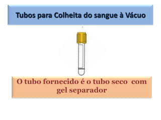 Tubos para Colheita do sangue à Vácuo




O tubo fornecido é o tubo seco com
           gel separador
 