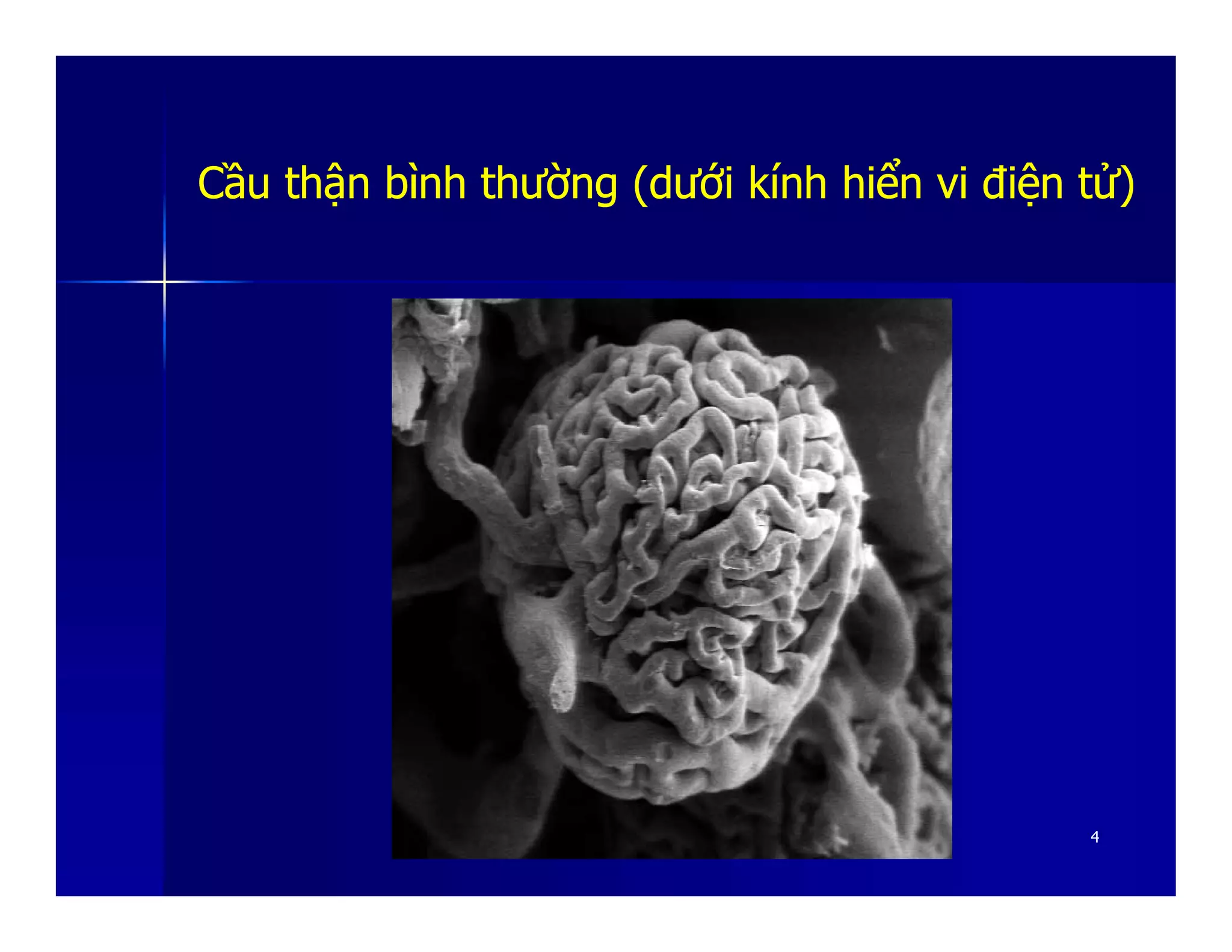 CầuCầu thậnthận bìnhbình thườngthường ((dướidưới kínhkính hiểnhiển vivi điệnđiện tửtử))
44
 