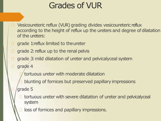Grades of VUR
Vesicoureteric reflux (VUR) grading divides vesicoureteric reflux
according to the height of reflux up the ureters and degree of dilatation
of the ureters:
grade 1:reflux limited to theureter
grade 2:reflux up to the renal pelvis
grade 3:mild dilatation of ureter and pelvicalyceal system
grade 4
tortuous ureter with moderate dilatation
blunting of fornices but preserved papillaryimpressions
grade 5
tortuous ureter with severe dilatation of ureter and pelvicalyceal
system
loss of fornices and papillary impressions.
 