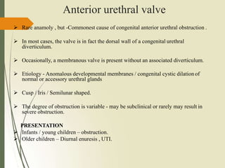 Anterior urethral valve
 Rare anamoly , but -Commonest cause of congenital anterior urethral obstruction .
 In most cases, the valve is in fact the dorsal wall of a congenital urethral
diverticulum.
 Occasionally, a membranous valve is present without an associated diverticulum.
 Etiology - Anomalous developmental membranes / congenital cystic dilation of
normal or accessory urethral glands
 Cusp / Iris / Semilunar shaped.
 The degree of obstruction is variable - may be subclinical or rarely may result in
severe obstruction.
PRESENTATION
 Infants / young children – obstruction.
 Older children – Diurnal enuresis , UTI.
 