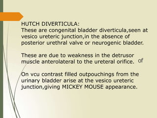 HUTCH DIVERTICULA:
These are congenital bladder diverticula,seen at
vesico ureteric junction,in the absence of
posterior urethral valve or neurogenic bladder.
These are due to weakness in the detrusor
muscle anterolateral to the ureteral orifice.
On vcu contrast filled outpouchings from the
urinary bladder arise at the vesico ureteric
junction,giving MICKEY MOUSE appearance.
of
 