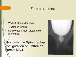 Female urethra
• Widest at bladder neck.
• 4-5cms in length
• Narrowest & least distensible
at meatus.
• This forms the Spinning top
configuration of urethra on
normal MCU.
 