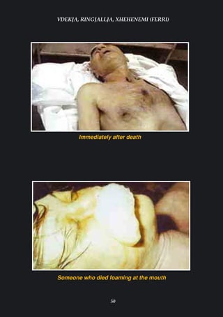 VDEKJA, RINGJALLJA, XHEHENEMI (FERRI)




       Immediately after death




Someone who died foaming at the mouth



                  50
 