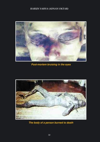 HARUN YAHYA (ADNAN OKTAR)




  Post-mortem bruising in the eyes




The body of a person burned to death



               51
 