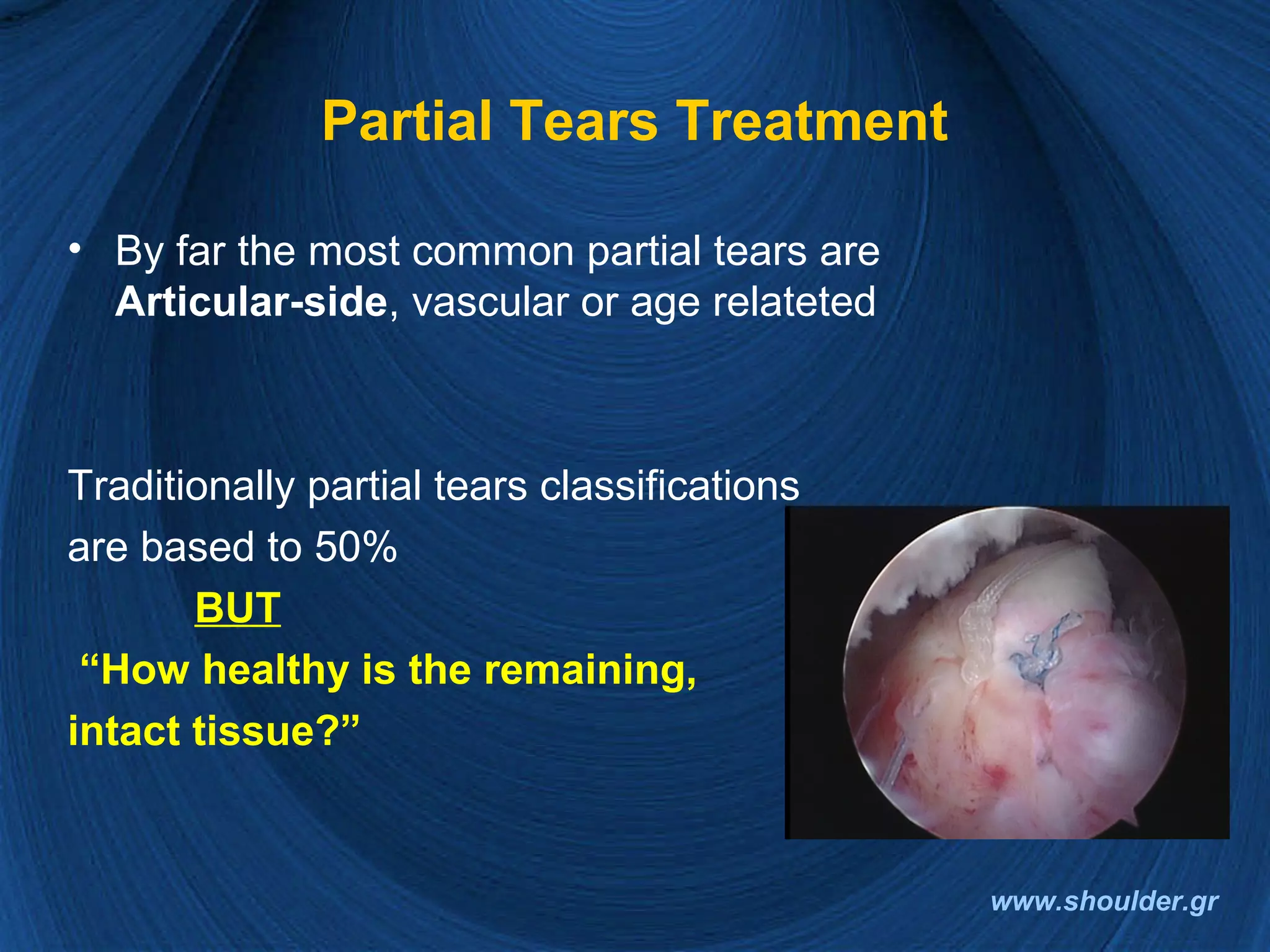 Rotator cuff 2008 final | PPT