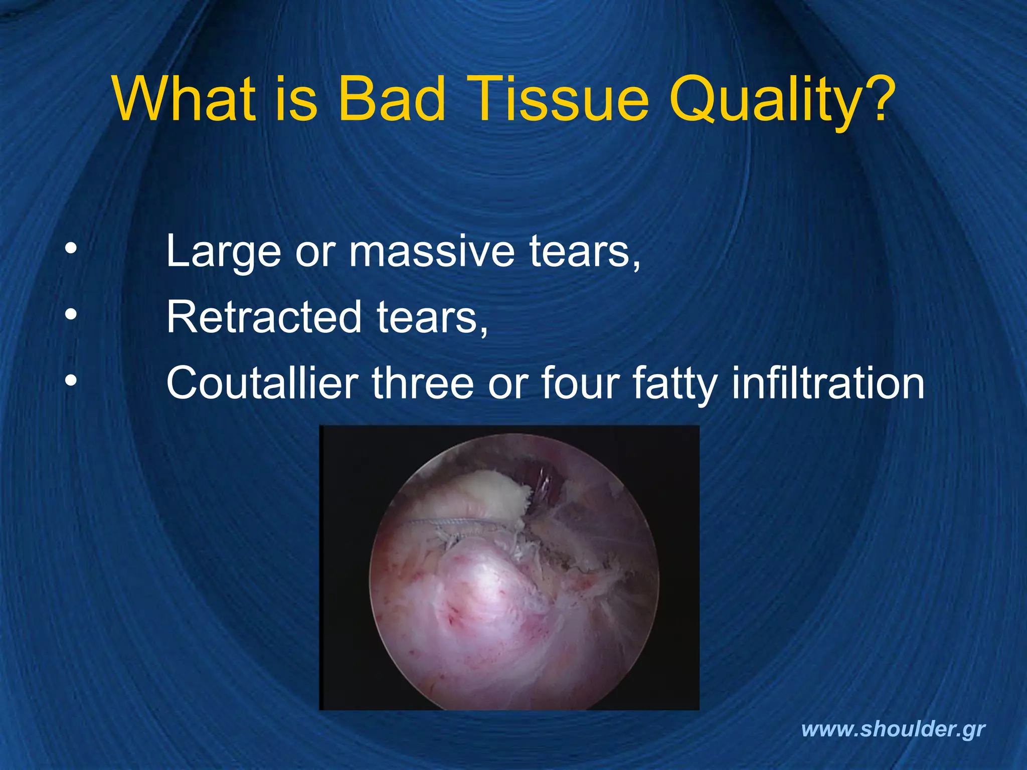 Rotator cuff 2008 final | PPT