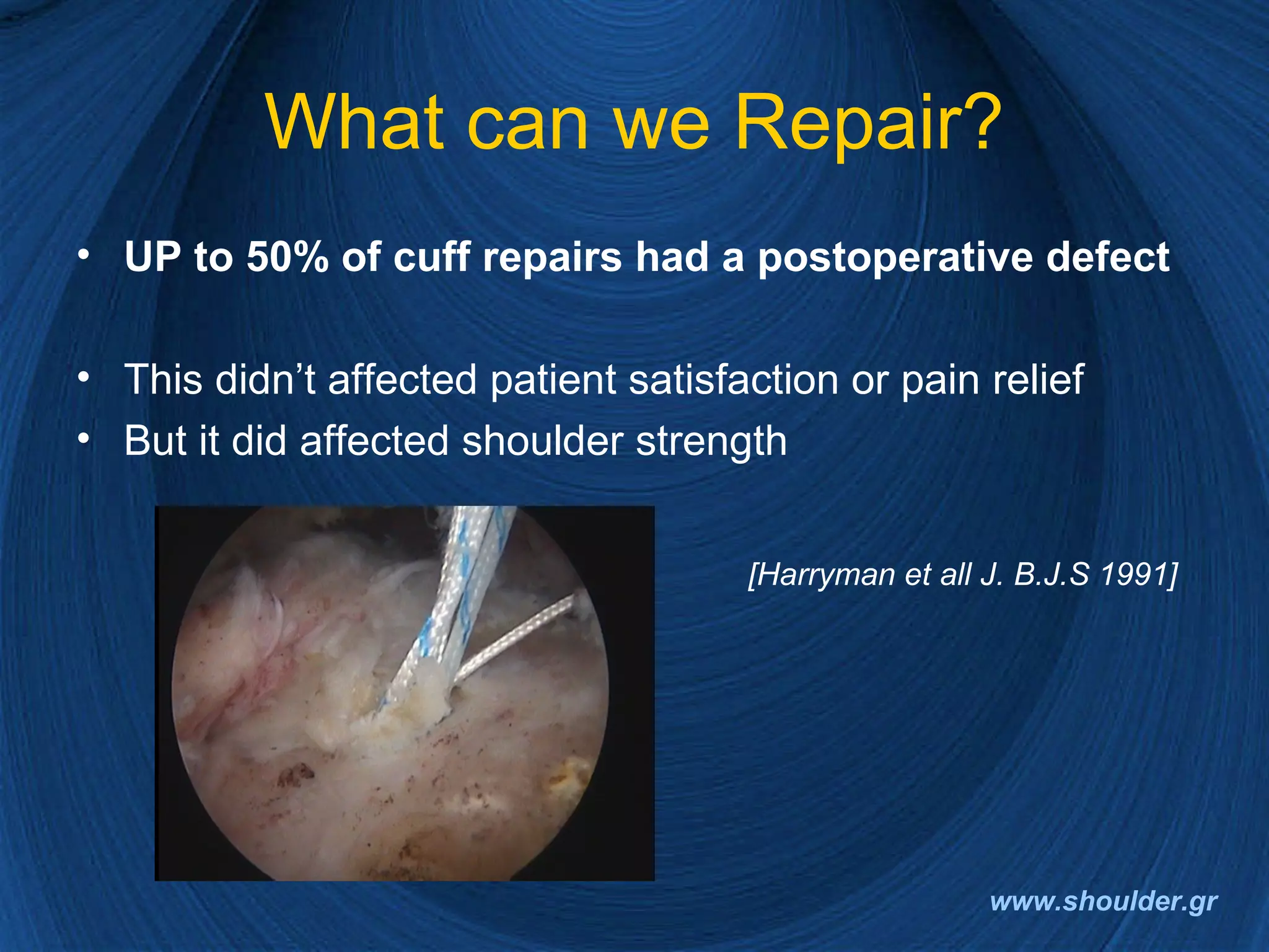 Rotator cuff 2008 final | PPT