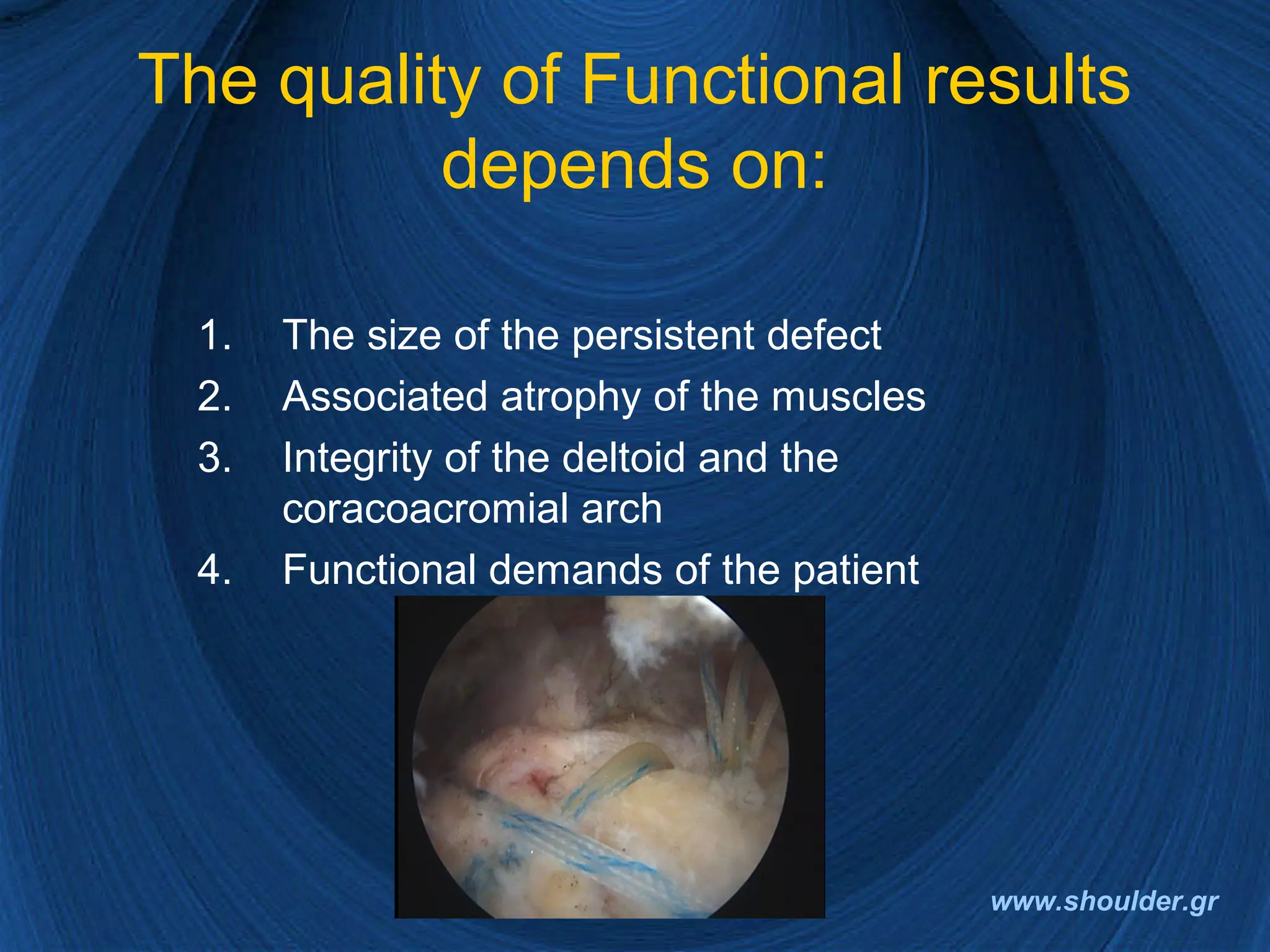 Rotator cuff 2008 final | PPT