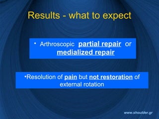 Results - what to expect
• Arthroscopic partial repair or
medialized repair
•Resolution of pain but not restoration of
external rotation
www.shoulder.gr
 