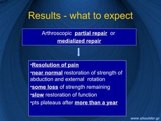 Results - what to expect
Arthroscopic partial repair or
medialized repair
•Resolution of pain
•near normal restoration of strength of
abduction and external rotation
•some loss of strength remaining
•slow restoration of function
•pts plateaus after more than a year
www.shoulder.gr
 