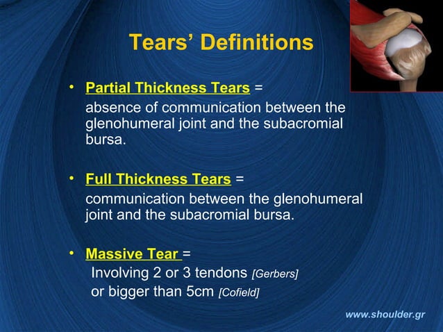 Rotator cuff 2008 final | PPT