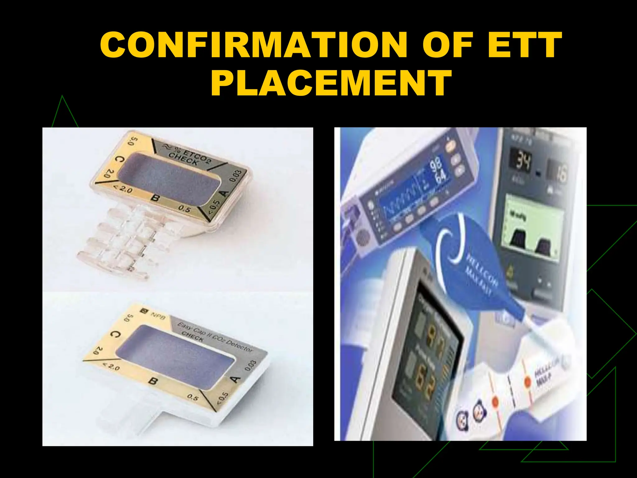 CONFIRMATION OF ETT
PLACEMENT
 