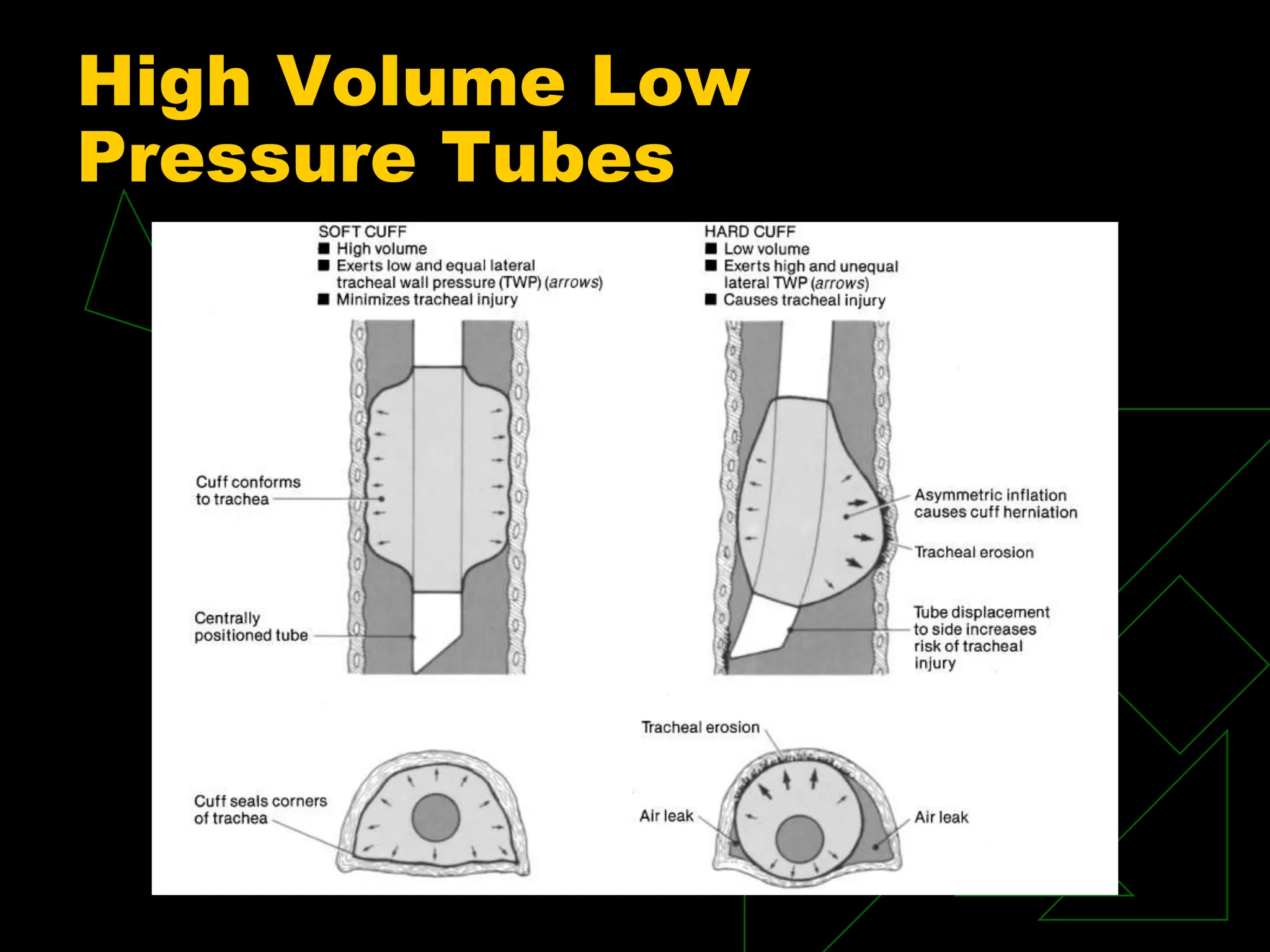 High Volume Low
Pressure Tubes
 
