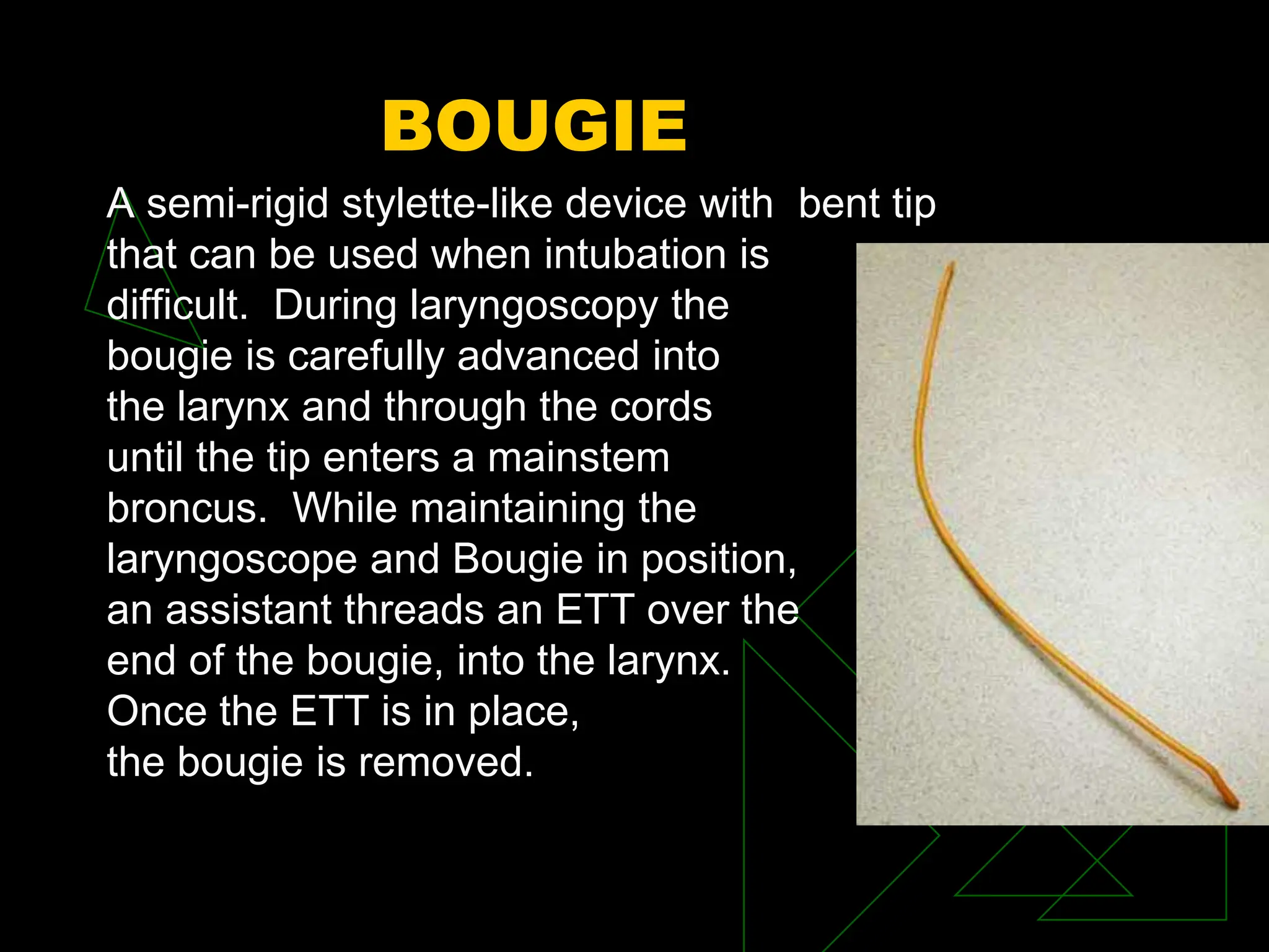 BOUGIE
A semi-rigid stylette-like device with bent tip
that can be used when intubation is
difficult. During laryngoscopy the
bougie is carefully advanced into
the larynx and through the cords
until the tip enters a mainstem
broncus. While maintaining the
laryngoscope and Bougie in position,
an assistant threads an ETT over the
end of the bougie, into the larynx.
Once the ETT is in place,
the bougie is removed.
 