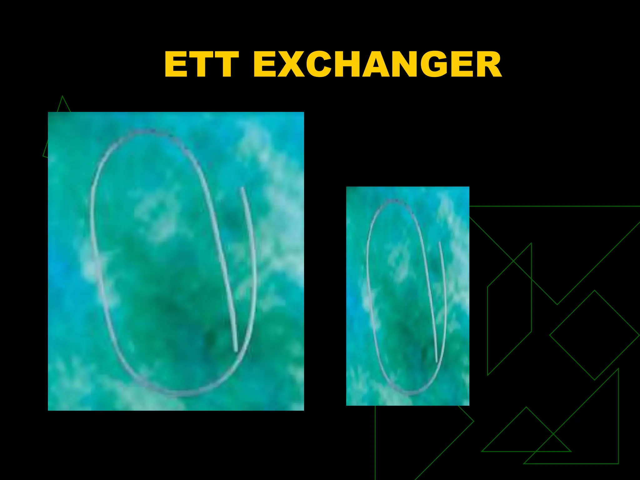 ETT EXCHANGER
 
