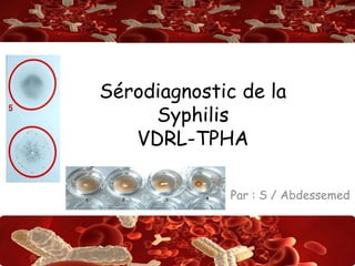 Abdsalah
Sérodiagnostic de la
Syphilis
VDRL-TPHA
Par : S / Abdessemed
 