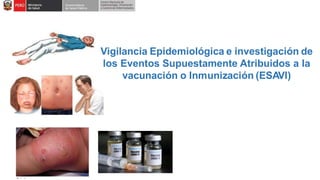 Vigilancia Epidemiológica e investigación de
los Eventos Supuestamente Atribuidos a la
vacunación o Inmunización (ESAVI)
 