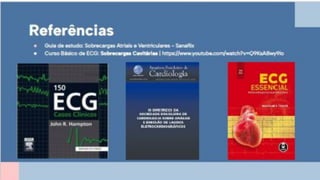 Apresentação sobre Sobrecarga de Ventrículo Esquerdo