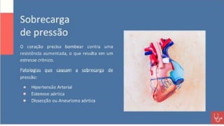 Apresentação sobre Sobrecarga de Ventrículo Esquerdo
