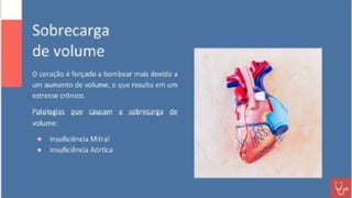 Apresentação sobre Sobrecarga de Ventrículo Esquerdo
