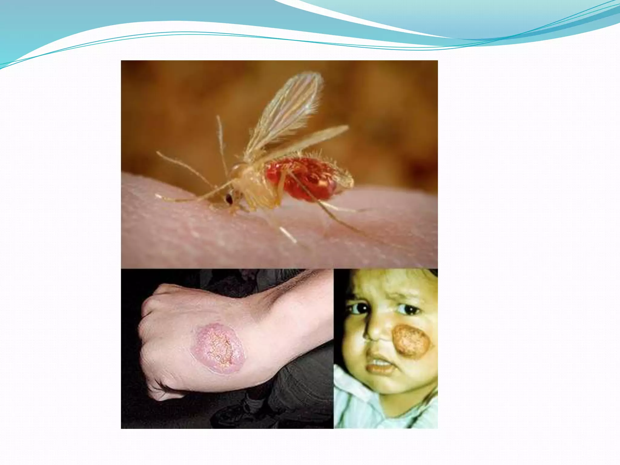 Vector and rodent control