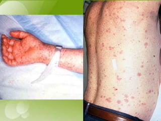 Vector and rodent control