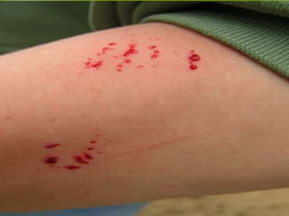 Vector and rodent control