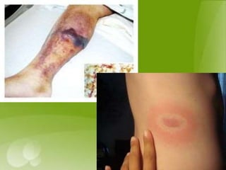 Vector and rodent control