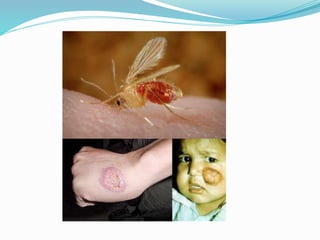 Vector and rodent control