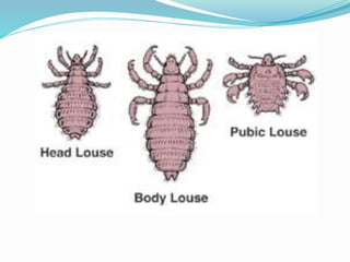 Vector and rodent control