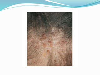 Vector and rodent control