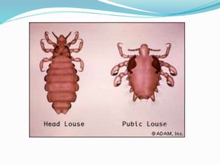 Vector and rodent control