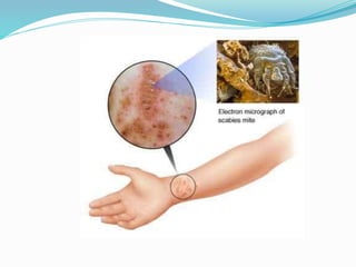 Vector and rodent control