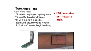 TOURNIQUET TEST
Goal of the test :-
 Toasses fragility of capillary walls
 T
oidentify thrombocytopenia
 In DHF grade 1, a positive
tourniquet test serves as the only
indicator of haemorrhagic tendency
• ≥20 petechiae
per 1 square
inch.
 