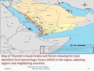 06/29/18
Prepared by Dr. Sana Abnawf
MD community medicine 14
 