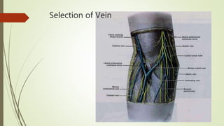 Selection of Vein
 