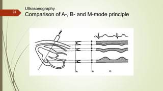 24
Ultrasonography
Comparison of A-, B- and M-mode principle
 
