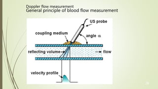 28
Doppler flow measurement
General principle of blood flow measurement
 
