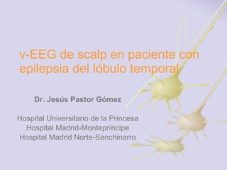 v-EEG de scalp en paciente con epilepsia del lóbulo temporal Dr. Jesús Pastor Gómez Hospital Universitario de la Princesa Hospital Madrid-Montepríncipe Hospital Madrid Norte-Sanchinarro 