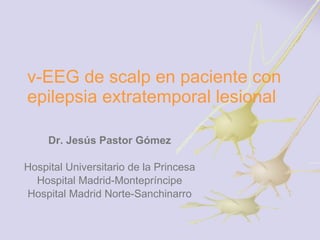 v-EEG de scalp en paciente con epilepsia extratemporal lesional Dr. Jesús Pastor Gómez Hospital Universitario de la Princesa Hospital Madrid-Montepríncipe Hospital Madrid Norte-Sanchinarro 