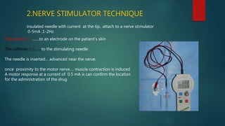2.NERVE STIMULATOR TECHNIQUE
insulated needle with current at the tip.. attach to a nerve stimulator
0-5mA ,1-2Hz
The anode (+) …….to an electrode on the patient’s skin
The cathode (−)…….to the stimulating needle.
The needle is inserted… advanced near the nerve.
once proximity to the motor nerve…. muscle contraction is induced
A motor response at a current of 0.5 mA is can confirm the location
for the administration of the drug
 