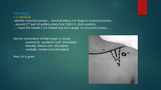TECHNIQUE
1 .CLASSICAL
identify coracoid process..... brachial plexus run Deep to coracoid process....
…around 2nd part of axillary artery b/w 3 &11 o’ clock position
….. insert the needle 2 cm medial and 2cm caudal to corocoid process…..
See for movememt of little finger, it moves
posteriorly : posterior cord stimulated
laterally: lateral cord stimulated
medially: medial cord stimulated
then LA is given
 