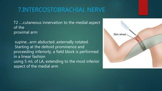 7.INTERCOSTOBRACHIAL NERVE
T2 ….cutaneous innervation to the medial aspect
of the
proximal arm
supine…arm abducted ,externally rotated.
Starting at the deltoid prominence and
proceeding inferiorly, a field block is performed
in a linear fashion
using 5 mL of LA, extending to the most inferior
aspect of the medial arm
 