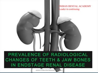 PREVALENCE OF RADIOLOGICALPREVALENCE OF RADIOLOGICAL
CHANGES OF TEETH & JAW BONESCHANGES OF TEETH & JAW BONES
IN ENDSTAGE RENAL DISEASEIN ENDSTAGE RENAL DISEASE
www.indiandentalacademy.comwww.indiandentalacademy.com
INDIAN DENTAL ACADEMY
Leader in continuing Dental Education
 