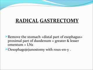carcinoma of stomach | PPT