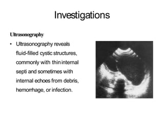 Investigations
Ultrasonography
• Ultrasonography reveals
fluid-filled cystic structures,
commonly with thininternal
septi and sometimes with
internal echoes from debris,
hemorrhage, or infection.
 