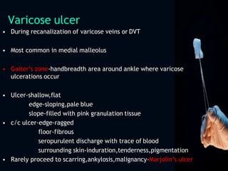 Varicose ulcer
• During recanalization of varicose veins or DVT
• Most common in medial malleolus
• Gaiter’s zone-handbreadth area around ankle where varicose
ulcerations occur
• Ulcer-shallow,flat
edge-sloping,pale blue
slope-filled with pink granulation tissue
• c/c ulcer-edge-ragged
floor-fibrous
seropurulent discharge with trace of blood
surrounding skin-induration,tenderness,pigmentation
• Rarely proceed to scarring,ankylosis,malignancy-Marjolin’s ulcer
 