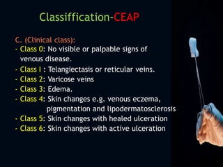 C. (Clinical class):
- Class 0: No visible or palpable signs of
venous disease.
- Class I : Telangiectasis or reticular veins.
- Class 2: Varicose veins.
- Class 3: Edema.
- Class 4: Skin changes e.g. venous eczema,
pigmentation and lipodermatosclerosis.
- Class 5: Skin changes with healed ulceration
- Class 6: Skin changes with active ulceration
Classiffication-CEAP
 